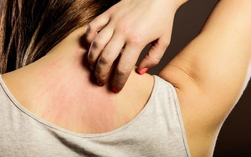 Νιώθετε φαγούρα στο σώμα; Δείτε όλες τις πιθανές αιτίες που μπορεί να την προκαλούν